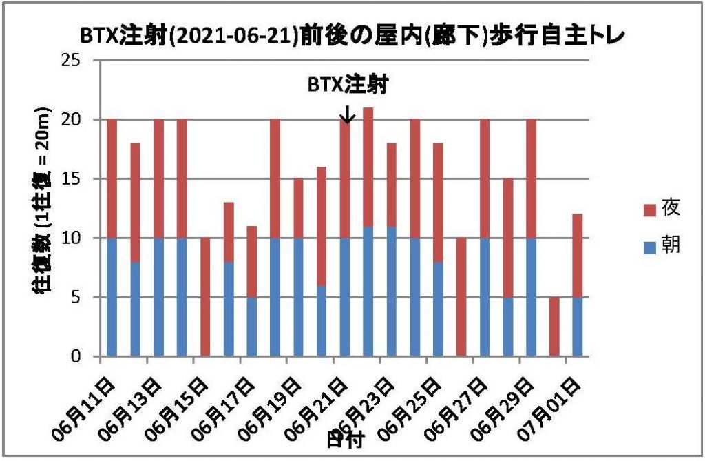BTX注射(2021-06-21)の前後の屋内歩行自主トレーニングの距離