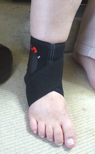 簡便なMcDavidのサポータを着けた右足