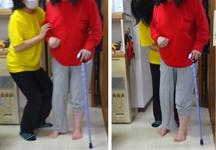 歩き始めの1歩目は麻痺のない足(左足)から