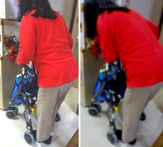 屋内歩行自主トレ中にも左右の体側に強い筋肉痛を感じる