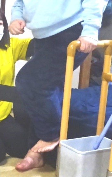 左脚上げのリハビリ中に左ふくらはぎがつる