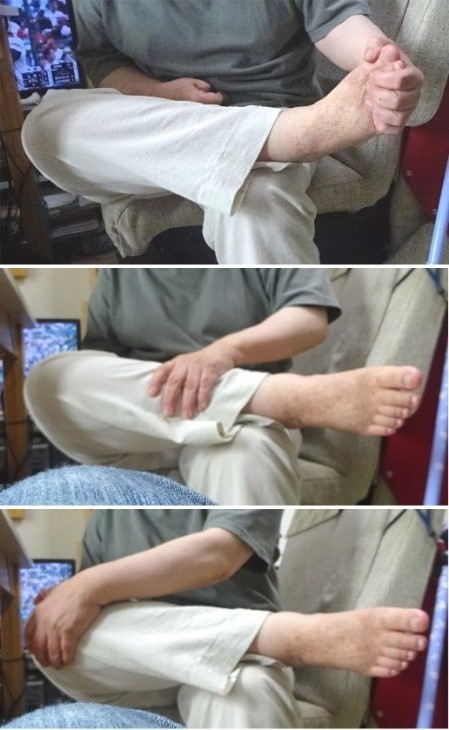 右の足先・すね(脛)・膝が発病前の状態に近づいている変化を感じてその付近を触る