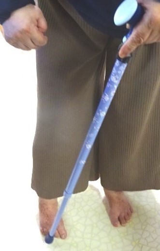 右足先が変わってきた